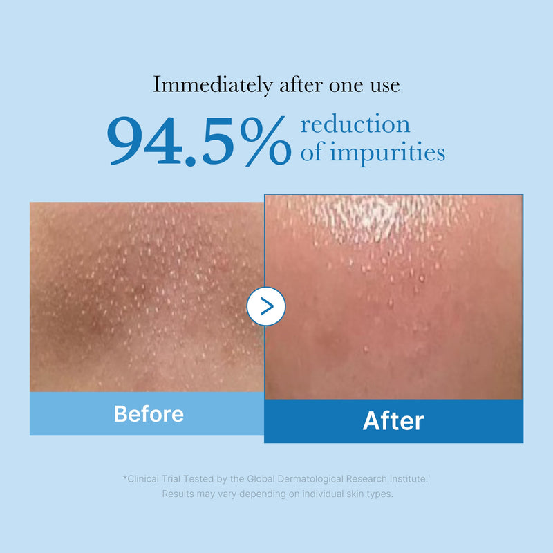 [GIFT] Zero Pore Blackhead Deep Cleansing Oil