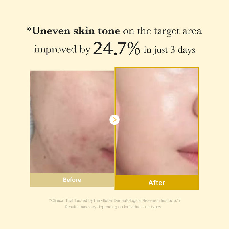 [GIFT] Kojic Acid Turmeric Overnight Wrapping Mask