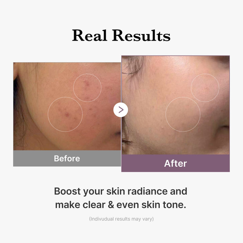 [GIFT] AGE-R Glutathione Glow Milk Toner