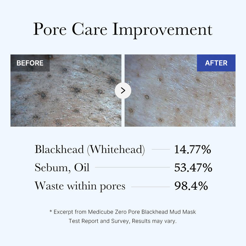 [Subscr.] Zero Pore Blackhead Mud Mask