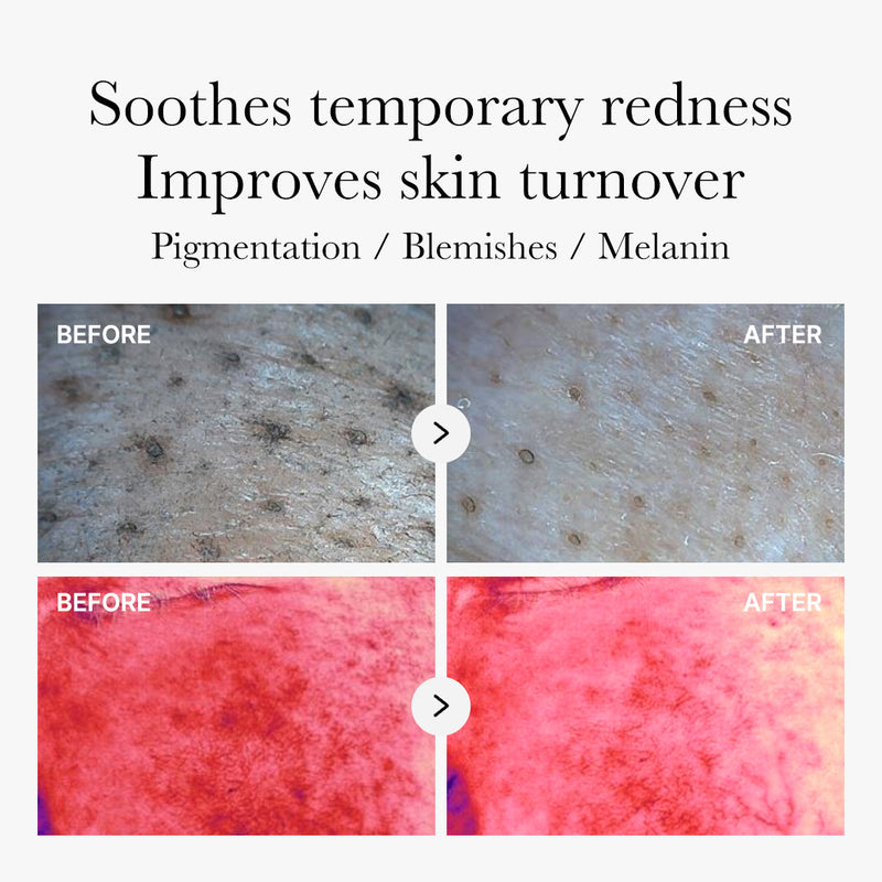 [GIFT] Red Succinic Acid Panthenol Pads